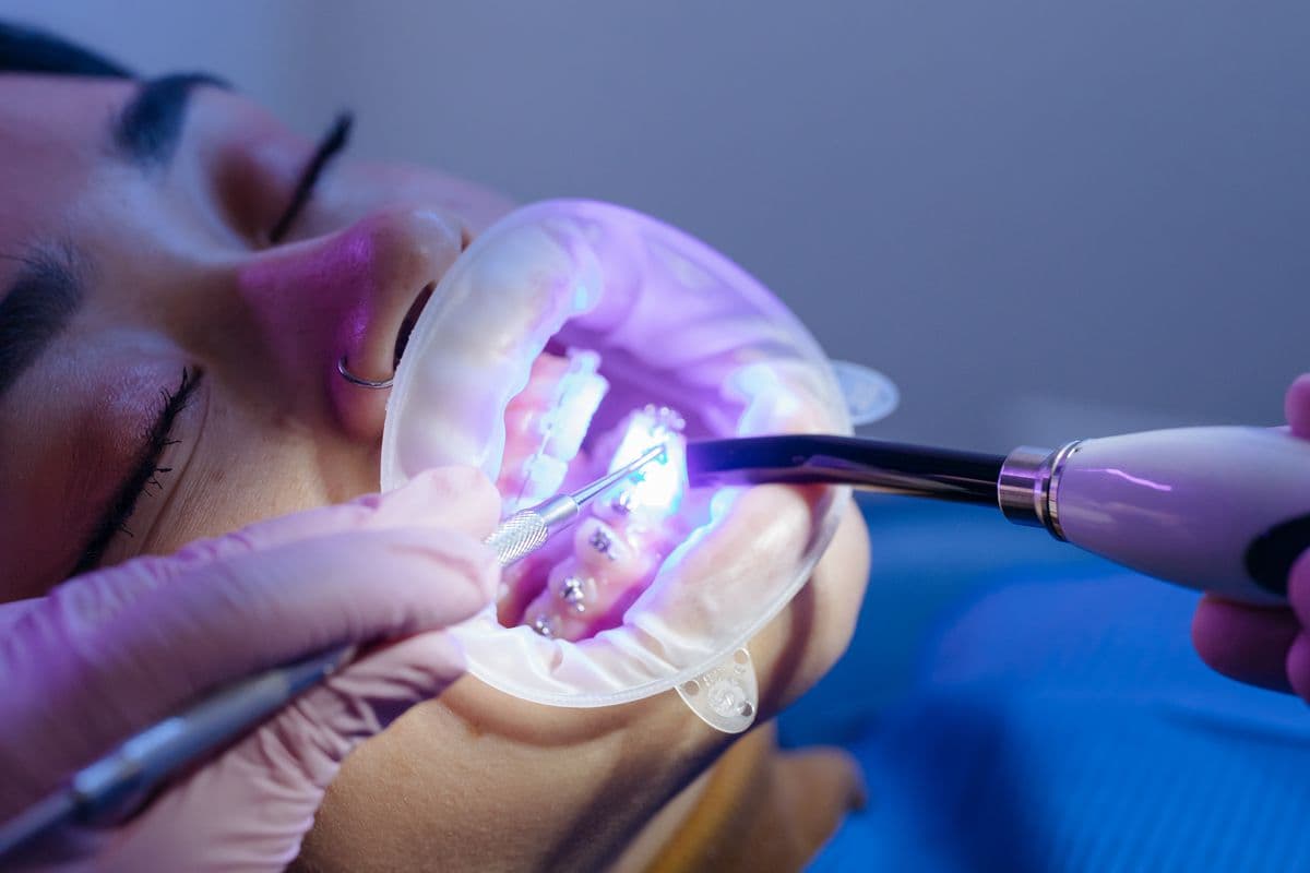 Orthodontic treatment with braces being adjusted by a dentist