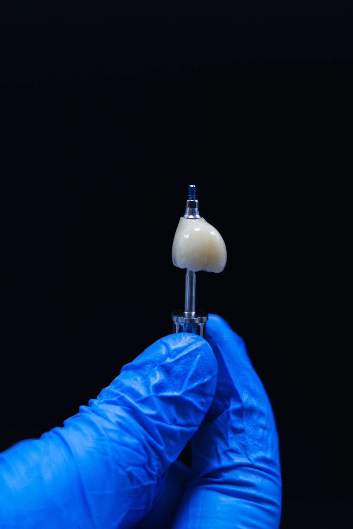 Close-up of a dental implant component held by a gloved hand, showing the titanium post and crown