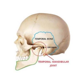 tmj-dysfunction